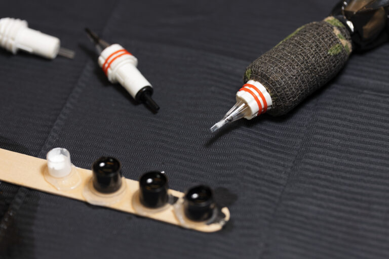 Tattoo Removal vs Cover-Up: Making the Right Choice